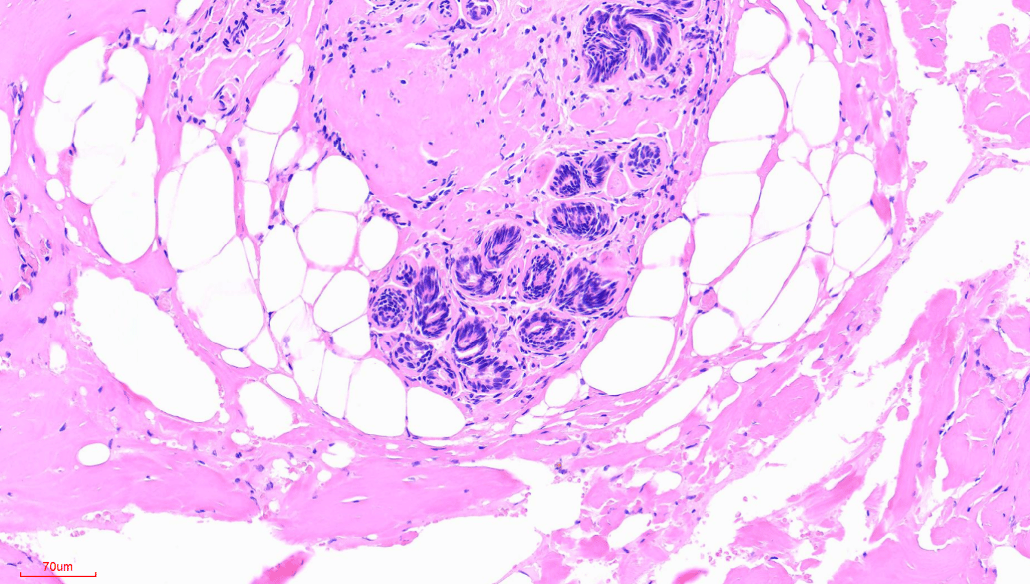 image of breast tumor tissue microarray