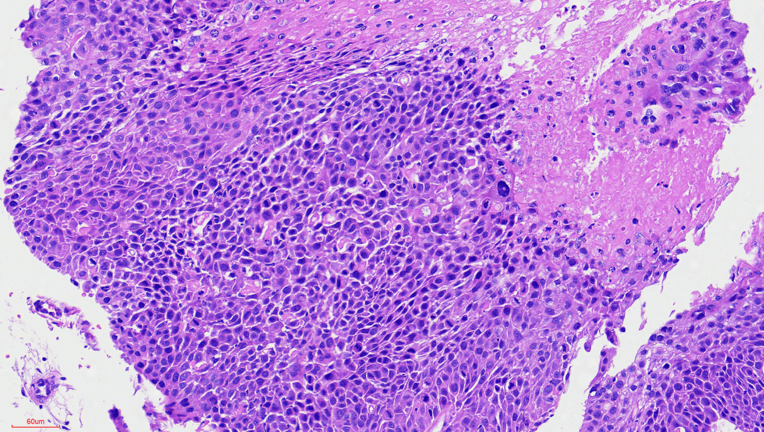 image of cervical tumor tissue microarray