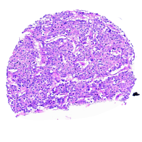 Mixed Gastrointestinal Tract Tumour Tissue Microarray (50 cases) – TMX002